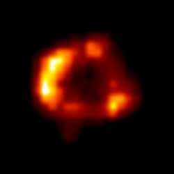 チャンドラによる超新星1987A