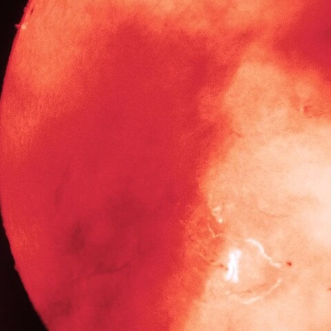 10/2朝の太陽(Hα　X7.1フレア発生中・X線最大の５分前)