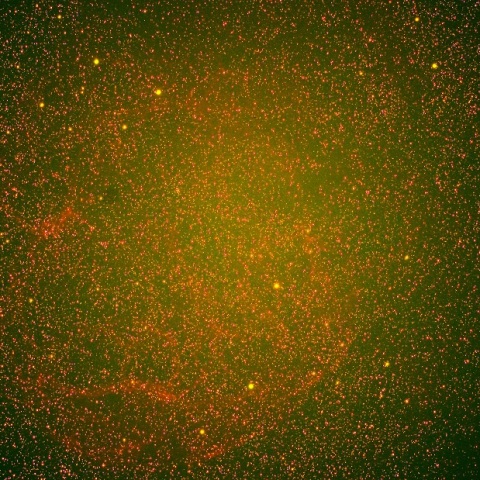 レムナント（Sh2-240）