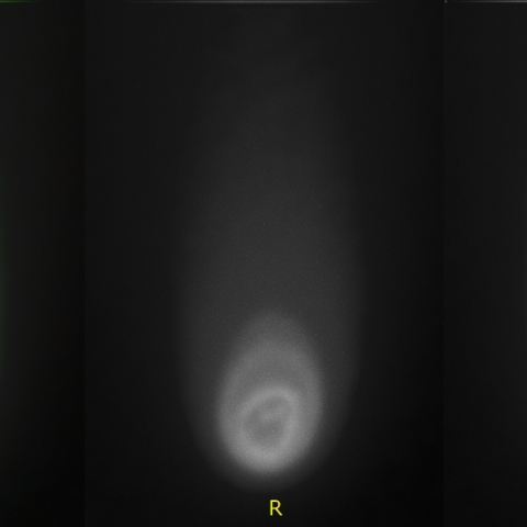 2024/10/20の紫金山・ATLAS彗星（再処理）