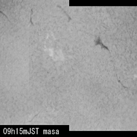 今日の太陽表面