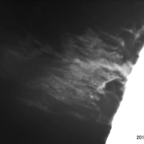 静穏型プロミネンス