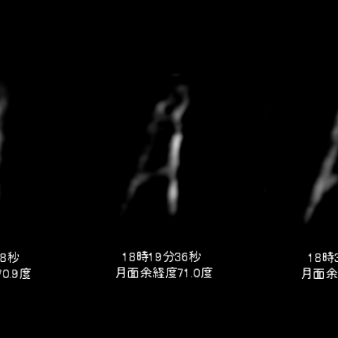 月のA字形の変化