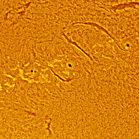 11.27黒点と周辺