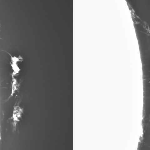 1月26日の太陽①（プロミネンス）　