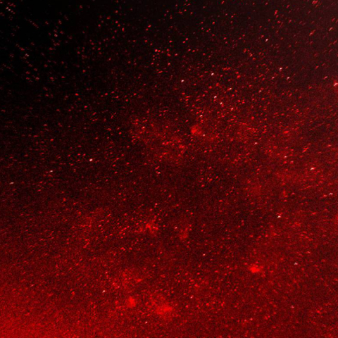 IC1396からクエスチョンマーク星雲